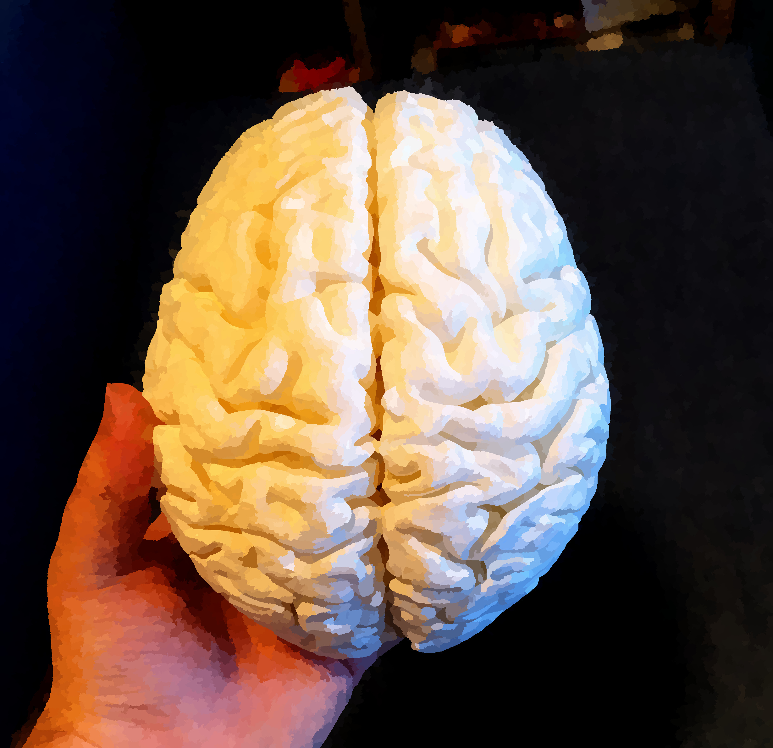 Birds' eye view of brain model